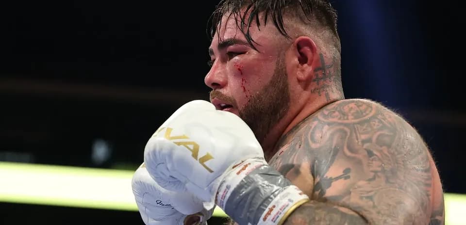 Boxeador con guantes, mostrando heridas en el rostro