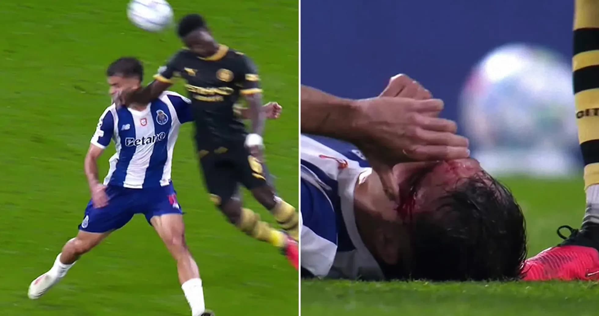 Jugador de Porto cae herido tras un choque