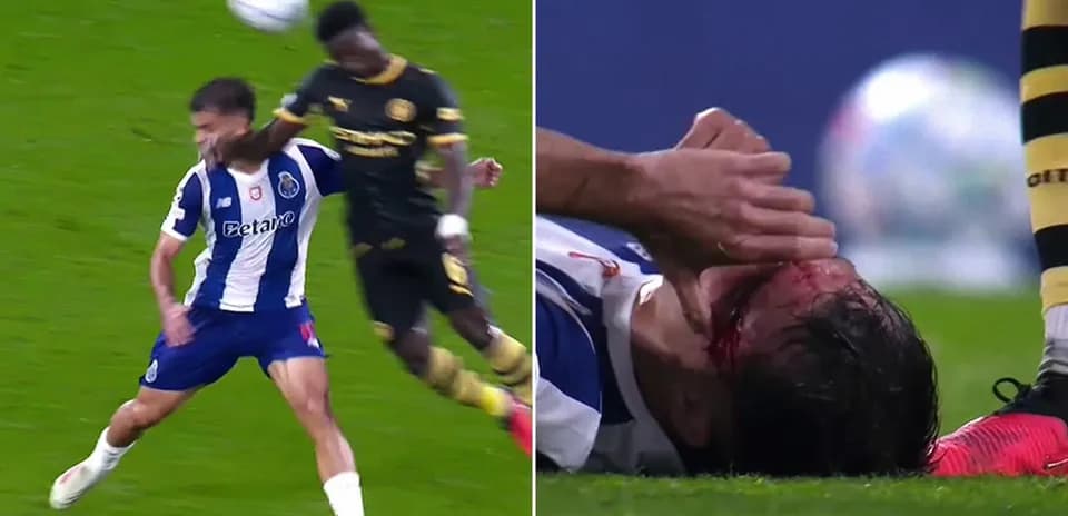 Jugador de Porto cae herido tras un choque